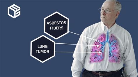 Asbestos Lung Cancer Claims Asbestos Exposure Elg Law