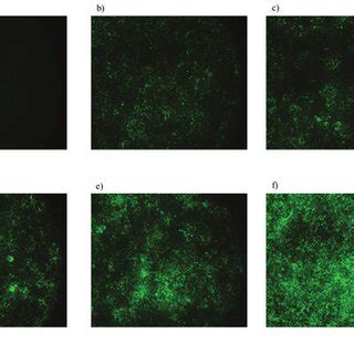 Titers Of Lentivirus Expressing GFP On HEK 293T Cells A