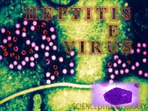 Microbiology Of Hepatitis E Virus Ppt