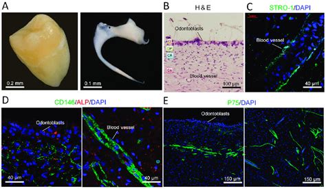 Characterization Of Human Dental Pulp Stem Cell Distribution A