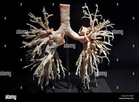 Plastinate Albero Bronchiale Dei Polmoni Umani Corpo Mondi Menschen