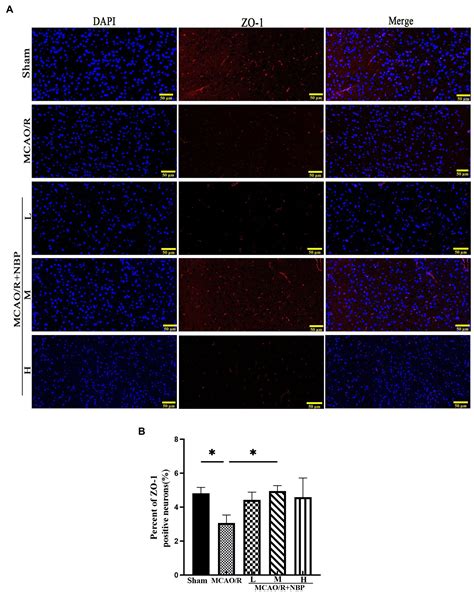 Frontiers Neuroprotective Effect Of Dl N Butylphthalide Against