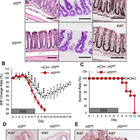 Defective Regeneration Of Colonic Epithelium In Irf2Δiec Mice A Hande