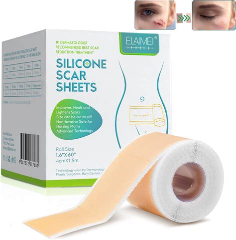 Biodermis Epi Derm Keloid Large Sheets Silicone Gel Sheeting For Scars Ideal For