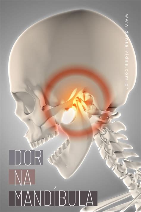 Dor Na Mand Bula Conhe A As Principais Causas Dela