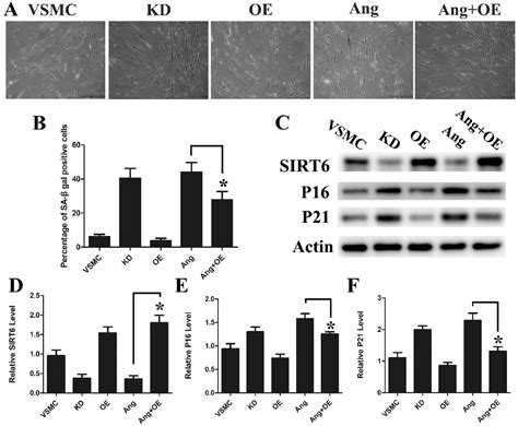 Sirt Mediated Vascular Smooth Muscle Cells Senescence Participates In