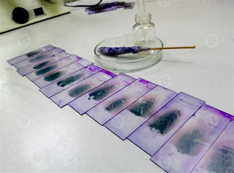 Stained Glass Slides Of Peripheral Blood Smear With Violet Off