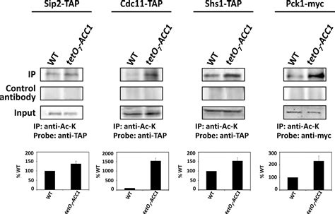 Acetyl Coa Carboxylase Regulates Global Histone Acetylation ♦ Journal Of Biological Chemistry