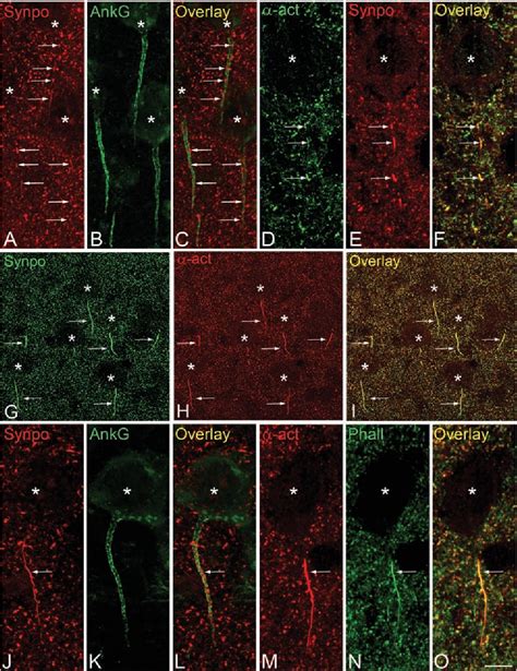 Figure 1 from Colocalization of α actinin and synaptopodin in the