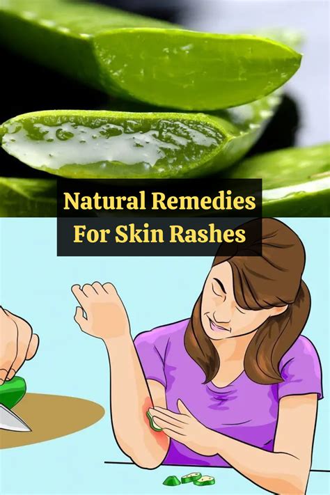 Irritated skin here are 9 all natural remedies to treat your skin the ...