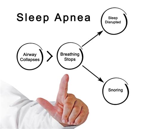 Sleep Apnea Is A Serious Issue Avenue Dental Care