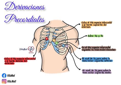 Derivaciones Precordiales Electrocardiograma Cosas De Enfermeria The