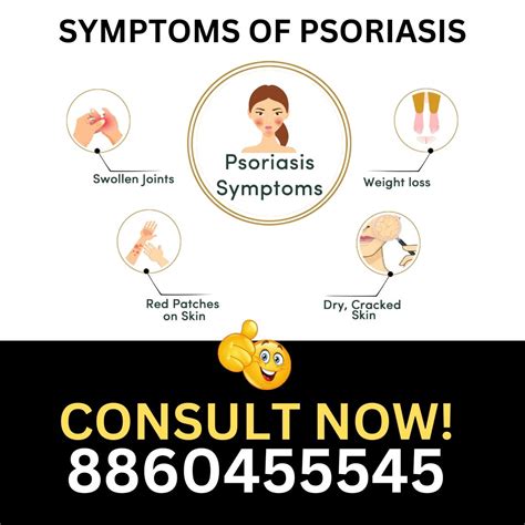 8860455545📞best Doctor For Psoriasis In Deoria By Dr Mishra Feb 2024 Medium