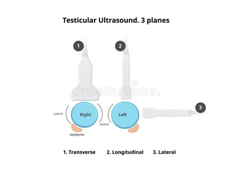 Ilustração Esquemática Da Ultrassonografia Testicular Ilustração Do