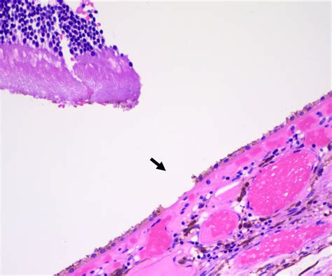 Ora Serrata Histology