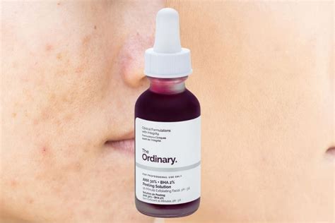 The Ordinary Peeling Solution For Acne Scars Aha Bha