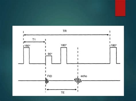 Mri Pulse Sequence Diagram