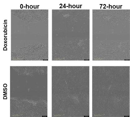 Assay Development To Monitor Cell Senescence Charnwood Discovery