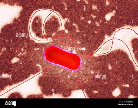 Coloured Transmission Electron Micrograph Tem Of An Escherichia Coli