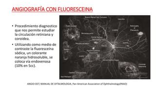 ANGIOGRAFÍA CON FLUORESCEÍNA 1 pptx