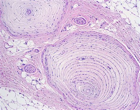 Pacinian Corpuscles Histology