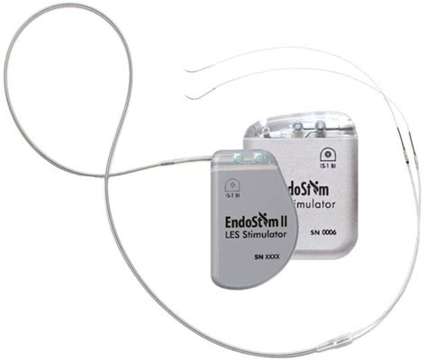 Endostim Launches Second Generation Neurostimulation Device For Gerd