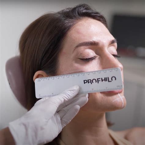 Profhilo Skin Booster Chalfont St Peter Gerrards Cross Face Teeth Smile