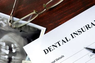 Let S Breakdown The Insurance Breakdown Form Part 1 Bond Dental Billing