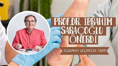 Prof Dr İbrahim Saraçoğlu Önerdi Egzamayı Geçirecek Tarif Egzama