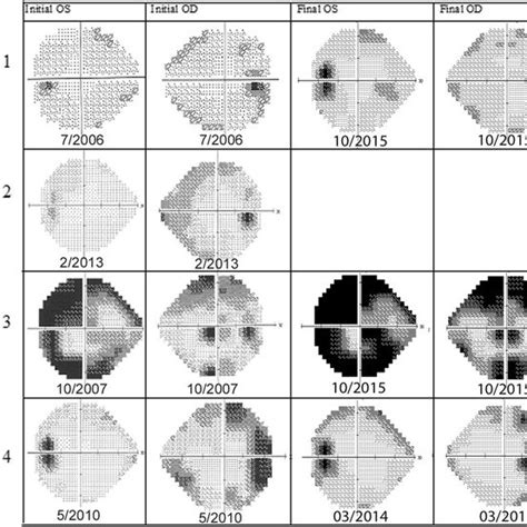 Modified Etdrs Grid Mm Overlapped To The Fundus Color