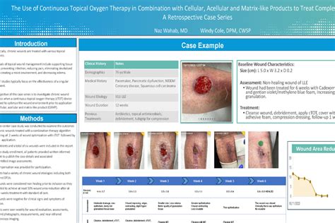 NATROX The Use Of Continuous Topical Oxygen Therapy CTOT In