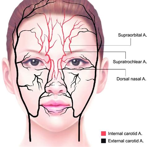 Doppler Ultrasound For Detection Of The Supratrochlear Artery The