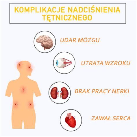 Choroby Uk Adu Kr Enia Przyczyny Objawy Rehabilitacja