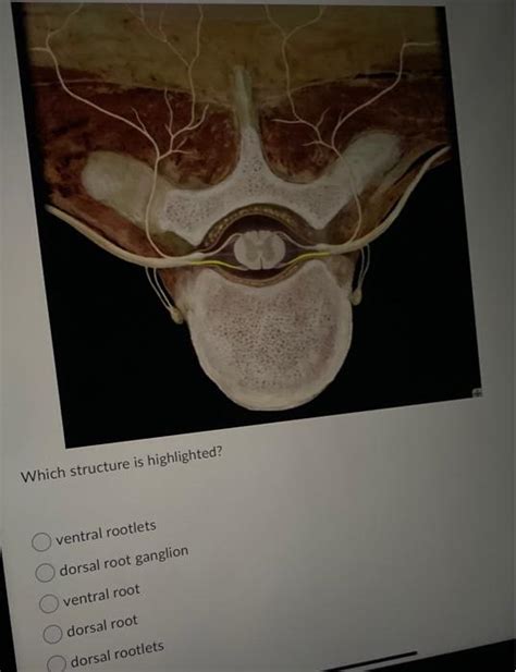 Solved Which Structure Is Highlighted Ventral Rootlets Chegg