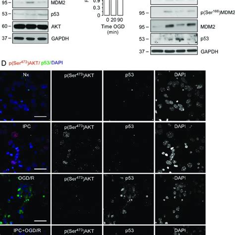 Akt Downregulation Prevents Ipc Induced Phosphorylation Of Akt At Ser