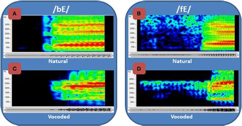 Spectrograms Of Normal And Vocoded Speech Spectrograms Of Speech Download Scientific Diagram