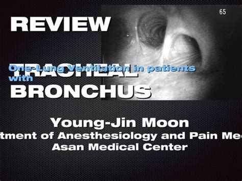 Nasogastric Tube Feeding Ppt