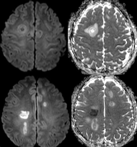 Daniel Gewolb Md On Twitter Interesting Case What Is The Most