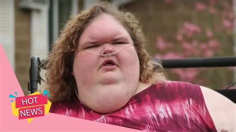 1000 Lb Sisters Why Fans Are Worried About Tammys Forehead Youtube