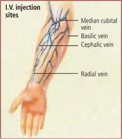 Iv Injection Sites Diagram Arm