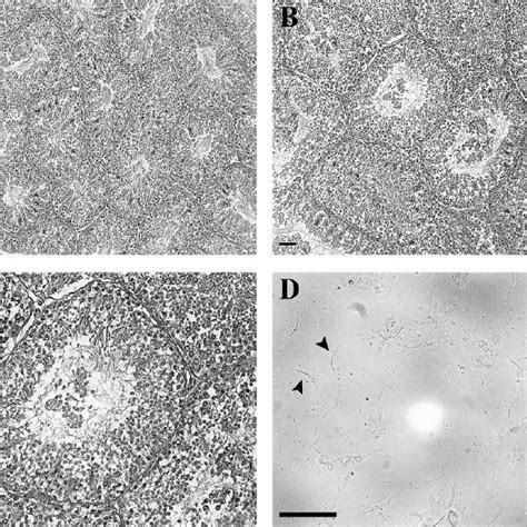 Histological Examination Of Testicular Tissue A Intact Male B