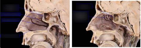 Anatomy Lab Cadaveric Dissection Diagram Quizlet