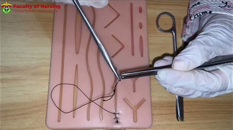 Teknik Suturing Simple Running Locking Suture Youtube