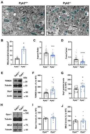 Cells Free Full Text Pyk2 Regulates Mams And Mitochondrial Dynamics