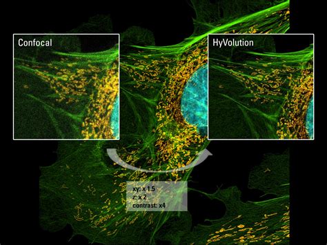 Advanced confocal laser scanning microscopy workshop - Australian ...