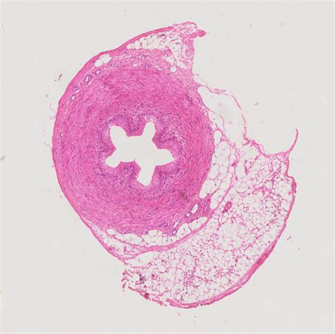 Human Ureter cross-section histology slides, 7 µm sec., H&E Stain ...