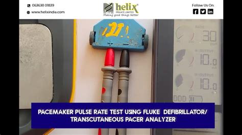 Pacemaker Pulse Rate Test Using Fluke Defibrillatortranscutaneous