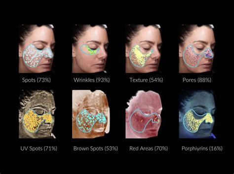 How VISIA Skin Analysis Uncovers Your Biggest Skin Concerns Mallucci