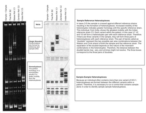 Interpretati On Of Heteroduplex Mobility Assay With Diff Erent Hiv