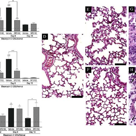 Time Course Of Bleomycin Induced Lung Inflammation And Fibrosis The